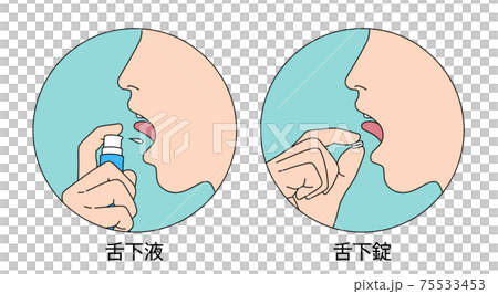 舌下免疫療法 服用 イラスト 75533453