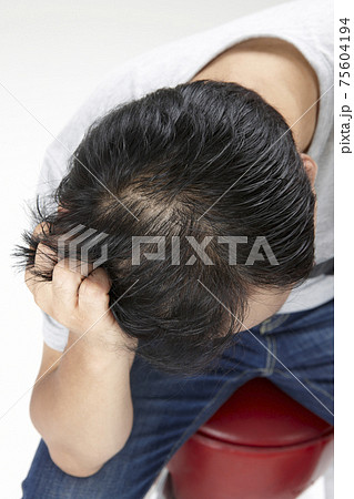 Middle-aged man under stress from hair loss - Stock Photo [75604194] - PIXTA