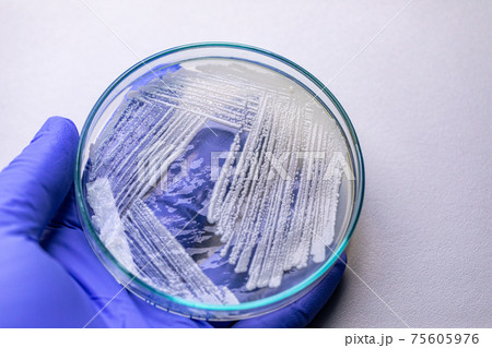 Pichia is a genus of yeasts in the family Saccharomycetaceae under the microscope for education. Pichia is a genus of yeasts in the family Saccharomycetaceae under the microscope for education. 75605976