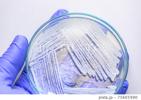 Pichia is a genus of yeasts in the family Saccharomycetaceae under the microscope for education. Pichia is a genus of yeasts in the family Saccharomycetaceae under the microscope for education. 75605990