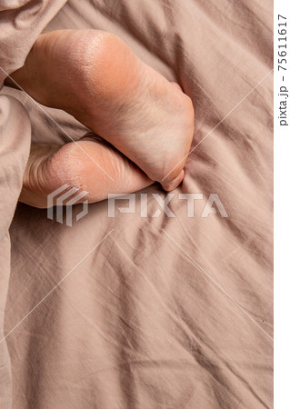 heel in the cracks of the smears on the legs woman foot lotion moisturizing female dry burrs, podiatrist callosity. Eczema apply dermatologist, health heel in the cracks of the smears on the legs woman foot lotion moisturizing female dry burrs, podiatrist callosity. Eczema apply dermatologist, health 75611617