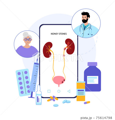 Kidney disease concept 75614798