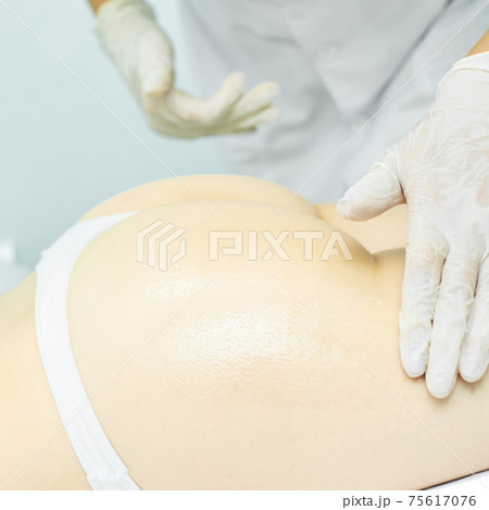 Body massage with oil. Doctor cosmetologist hands. Anti cellulite Body massage with oil. Doctor cosmetologist hands. Anti cellulite 75617076