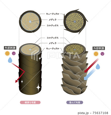 Hair cross section 4_1 Hair cross section 4_1 75637108