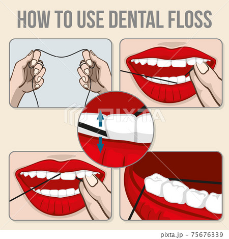 Flossing teeth infographics 75676339