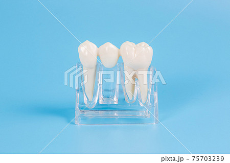 Dental crowns, imitation of a dental prosthesis of a dental bridge for one tooth Dental crowns, imitation of a dental prosthesis of a dental bridge for one tooth 75703239