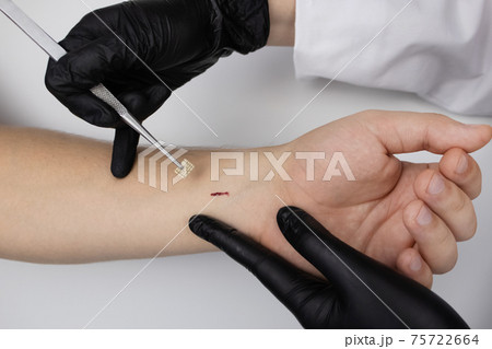 The cosmetic surgeon made a small incision to insert the chip into the patient's arm. Biotechnology, electronic documents and technological future concept 75722664