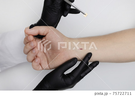 The cosmetic surgeon made a small incision to insert the chip into the patient's arm. Biotechnology, electronic documents and technological future concept The cosmetic surgeon made a small incision to insert the chip into the patient's arm. Biotechnology, electronic documents and technological future concept 75722711