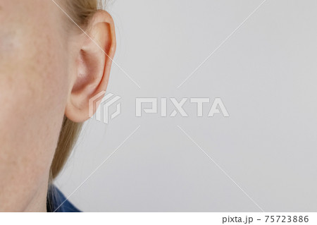 Darwin's tubercle on the ear. The girl at the reception at the plastic surgeon, shows the auricle. Darwin's tubercle on the ear. The girl at the reception at the plastic surgeon, shows the auricle. 75723886