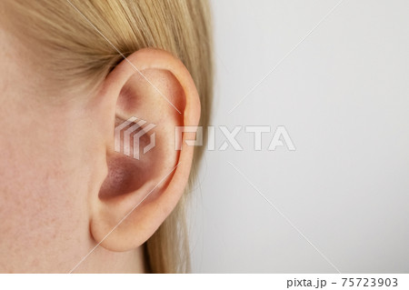 Darwin's tubercle on the ear. The girl at the reception at the plastic surgeon, shows the auricle. 75723903