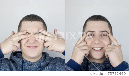 Before and after. On the left the man indicates eyes pain, and on the right, indicates that the eyes no longer hurts. Medical care assistance concept in the treatment of conjunctivitis and eye fatigue 75732440
