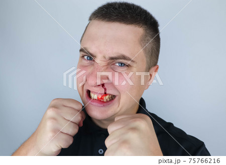 The man shakes his fists, shows aggressive behavior and has a broken nose. The concept of male brawls, fights and unrestrained aggression. Isolated on white background The man shakes his fists, shows aggressive behavior and has a broken nose. The concept of male brawls, fights and unrestrained aggression. Isolated on white background 75766216