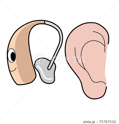 耳と補聴器のイラスト 75767520