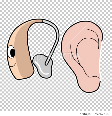 耳と補聴器のイラスト 75767520