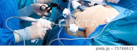 The surgeon holds special medical instruments in his hands during the operation. 75786615