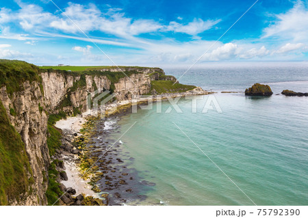 Carrick-a-Rede, Causeway Coast 75792390