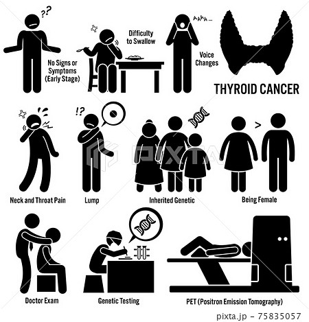 Thyroid Cancer Symptoms Causes Risk Factors Diagnosis Stick Figure Pictogram Icons. Thyroid cancer disease which include the symptoms, causes, risk factors, and the diagnosis for the illness. 75835057