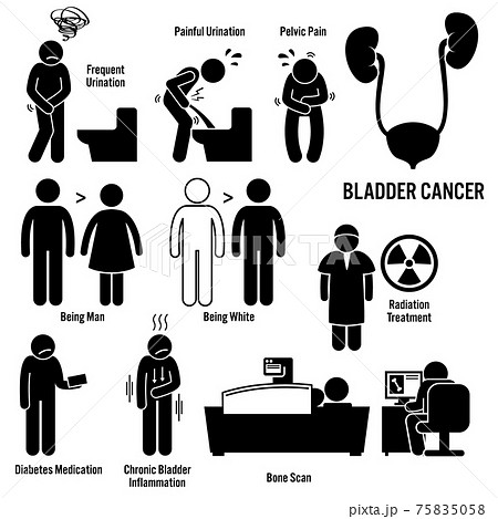 Bladder Cancer Symptoms Causes Risk Factors Diagnosis Stick Figure Pictogram Icons. Bladder cancer disease which include the symptoms, causes, risk factors, and the diagnosis for the illness. 75835058