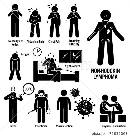 Non-Hodgkin Lymphoma Lymphatic Cancer Symptoms Causes Risk Factors Diagnosis Stick Figure Pictogram Icons.  75835063