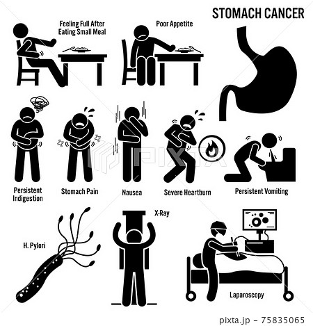 Stomach Cancer Symptoms Causes Risk Factors Diagnosis Stick Figure Pictogram Icons. Stomach cancer disease which include the symptoms, causes, risk factors, and the diagnosis for the illness. Stomach Cancer Symptoms Causes Risk Factors Diagnosis Stick Figure Pictogram Icons. Stomach cancer disease which include the symptoms, causes, risk factors, and the diagnosis for the illness. 75835065