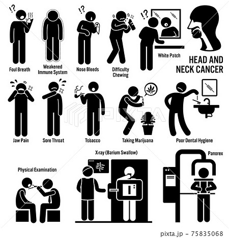 Head and Neck Cancer Symptoms Causes Risk Factors Diagnosis Stick Figure Pictogram Icons.  75835068