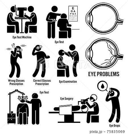 Eye Diagnosis Exam Surgery Optometrist Stick Figure Pictogram Icons.  75835069