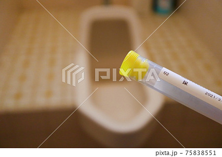 尿検査のキット 75838551