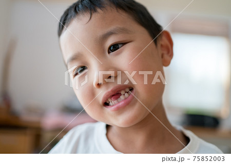 乳歯の生え変わり 75852003