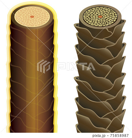 Hair cross section 20_2 No commentary 75858987