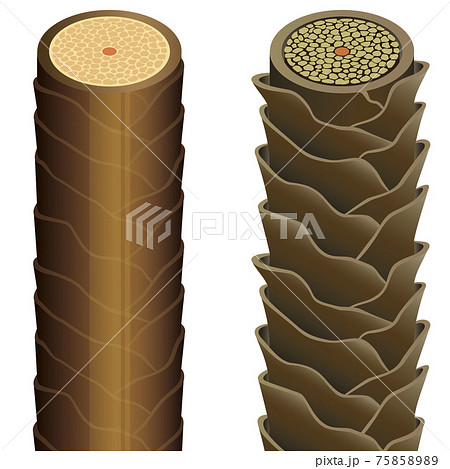 Hair cross section 20_1 No commentary 75858989