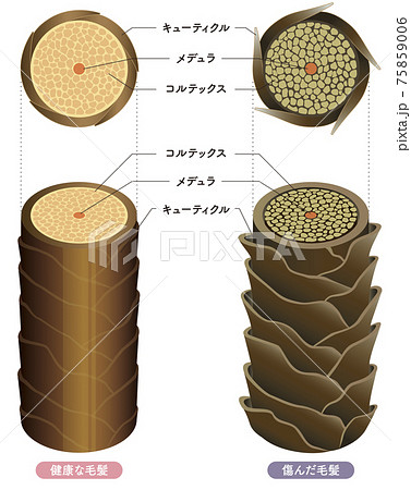 Hair cross section 4_3 Hair cross section 4_3 75859006