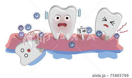 半立体のデンタルケアイラスト 虫歯菌に歯周が侵されて歯周病になるのイラスト素材