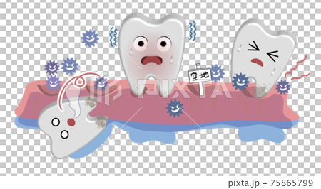 Semi-three-dimensional dental care illustration-Periodontal disease invades the periodontal disease 75865799