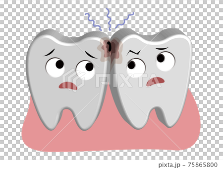 半立體牙齒護理插畫-牙菌斑殘留和牙齒變髒 半立體牙齒護理插畫-牙菌斑殘留和牙齒變髒 75865800