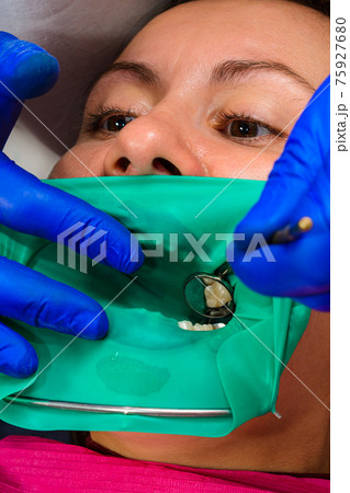 The dentist treats the patient's tooth with a rubber dam, drill, mirror. The dentist treats the patient's tooth with a rubber dam, drill, mirror. 75927680