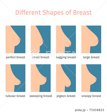 Ideas about the ideal breast shape, by morrisjohny