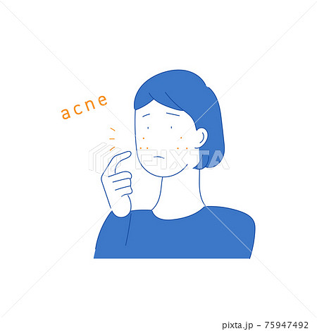 肌トラブル ニキビで悩む女性のイラストのイラスト素材