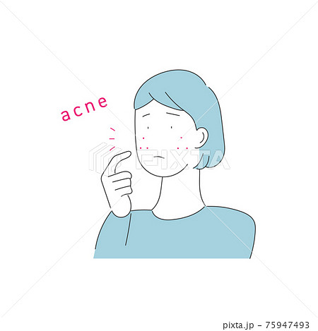 肌トラブル ニキビで悩む女性のイラストのイラスト素材