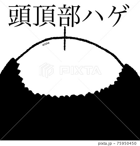 頭頂部ハゲのイラスト素材