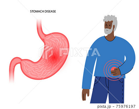 Stomach disease concept 75976197