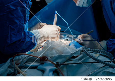 The surgeon makes incisions in the skin with an electrocoagulator. The surgeon makes incisions in the skin with an electrocoagulator. 75977695