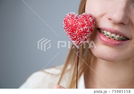 Cute woman with braces on her teeth holds a candy in the form of a heart on white background. Copy space Cute woman with braces on her teeth holds a candy in the form of a heart on white background. Copy space 75985158