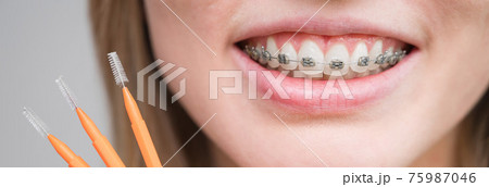 Close-up portrait of a woman with braces on her teeth holding a brush. Close-up portrait of a woman with braces on her teeth holding a brush. 75987046