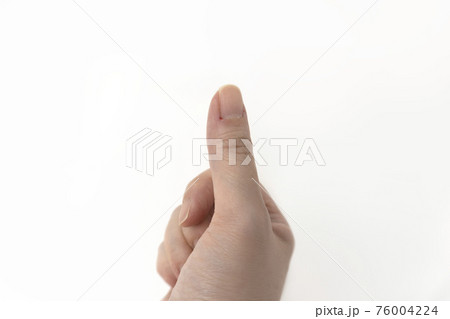 ささくれで出血した女性の親指の写真素材