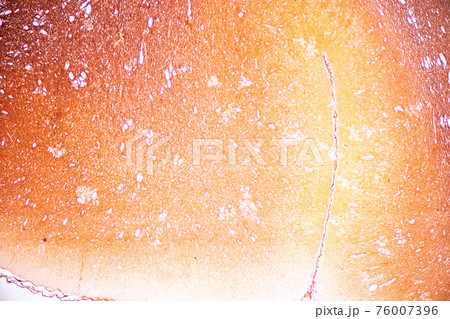 Education Spinal cord, Nerve, Cerebellum, Cortex and Motor Neuron Human under the microscope in Lab. 76007396