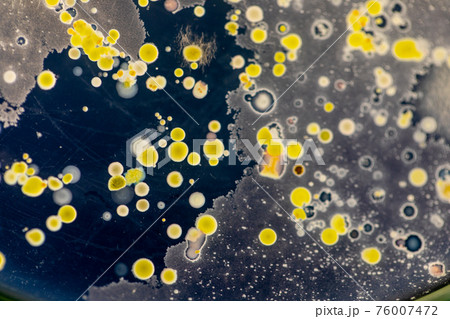 Mold Beautiful, Colony of Characteristics of Fungus (Mold) in culture medium plate from laboratory microbiology. Mold Beautiful, Colony of Characteristics of Fungus (Mold) in culture medium plate from laboratory microbiology. 76007472
