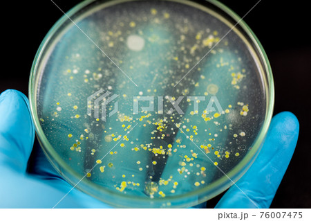 Mold Beautiful, Colony of Characteristics of Fungus (Mold) in culture medium plate from laboratory microbiology. Mold Beautiful, Colony of Characteristics of Fungus (Mold) in culture medium plate from laboratory microbiology. 76007475