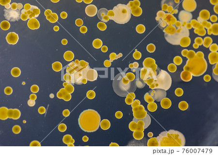 Mold Beautiful, Colony of Characteristics of Fungus (Mold) in culture medium plate from laboratory microbiology. 76007479