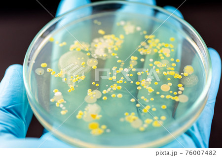 Mold Beautiful, Colony of Characteristics of Fungus (Mold) in culture medium plate from laboratory microbiology. Mold Beautiful, Colony of Characteristics of Fungus (Mold) in culture medium plate from laboratory microbiology. 76007482