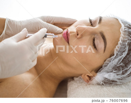 Beautician doing beauty procedure with syringe to face of young brunette woman in sunny clinic. Cosmetic medicine and surgery, beauty injections 76007696